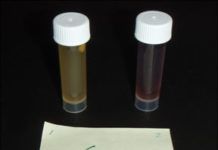 SteriPEN Portable UV Water Purifier