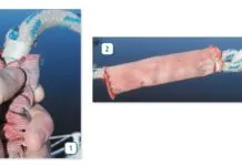 Sewn Splices Two-Year Followup