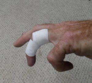 Tendon braicing tape finished with a second base wrap and ready to pull on lines. (Photo/ Drew Frye)