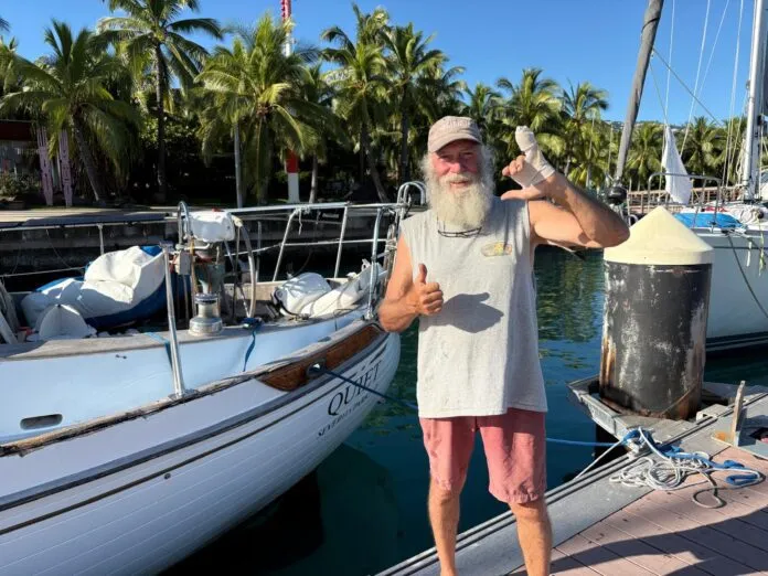 While setting anchor after nearly 100 days at sea, John ripped off part of his pinkie finger. He communicated with the author via voice memo to help this article come to life. (Photo/ John Jones)