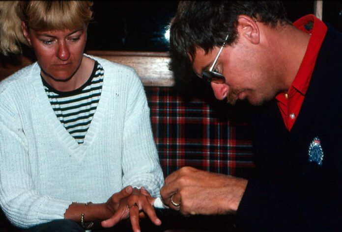 A bit of triage for Carey's ripped fingers. (Photo/ Bert Vermeer)